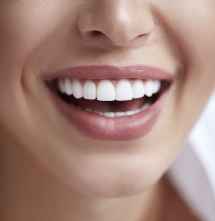 Close up of a smiling person with straight white teeth