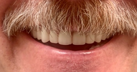 Man with mustache smiling with all of his teeth