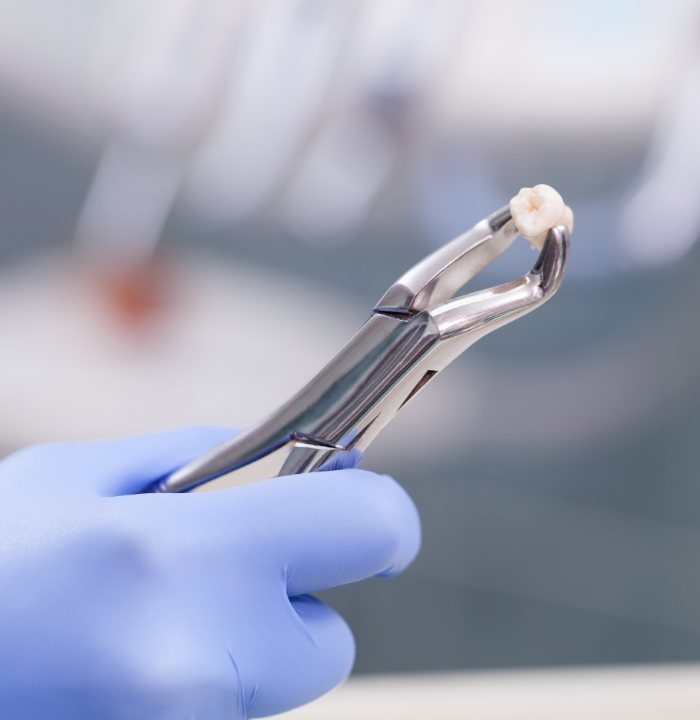 Dental forceps holding an extracted wisdom tooth