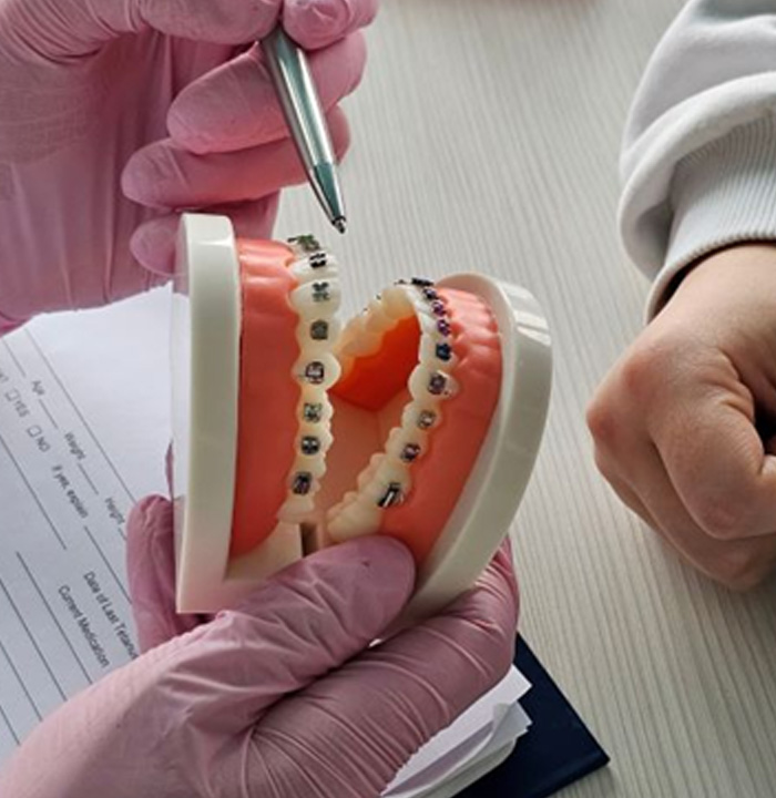 Dentist using model to answer questions about braces