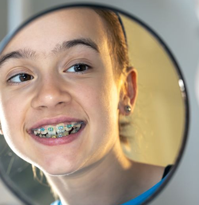 Teen girl looking at her braces in mirror
