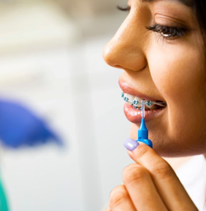 Young woman using interdental brush to clean around her braces
