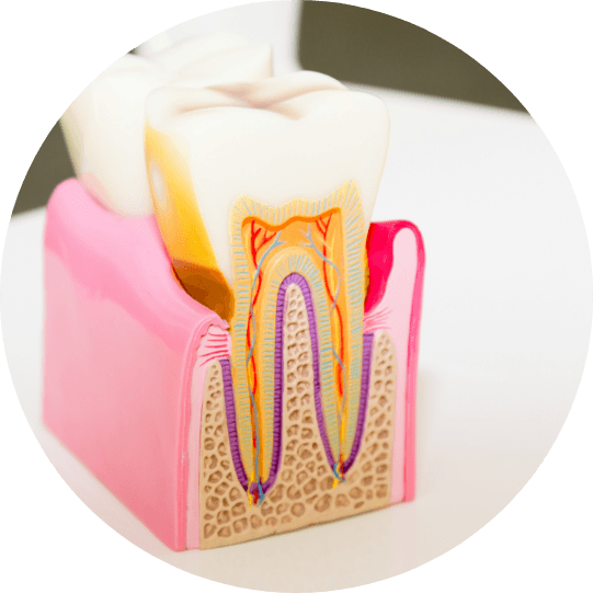 Model of tooth showing inner root canal layers